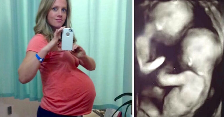 Expired: Moeder is zwanger van tweeling, maar dan zien artsen iets vreemds op haar echo…